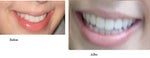 Before (left) and after (right)